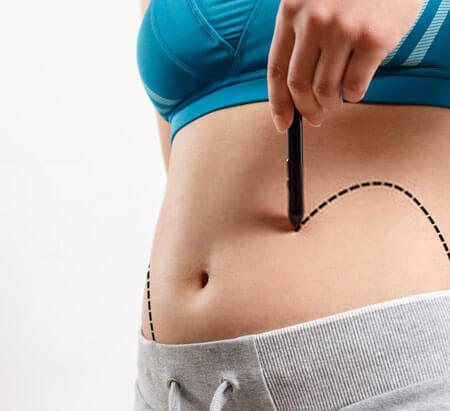 chirurgie esthétique post bariatrique