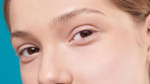 alopécie sourcils