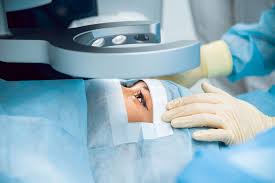 chirurgie yeux au laser
